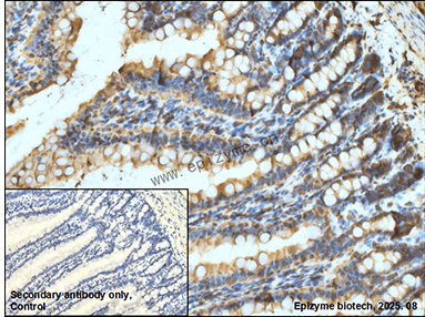 Anti-AP2S1 Rabbit mAb [29E15M06]
