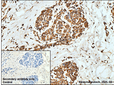Anti-AP2S1 Rabbit mAb [29E15M06]