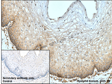 Anti-Caspase 3 Rabbit mAb [37I79I28]