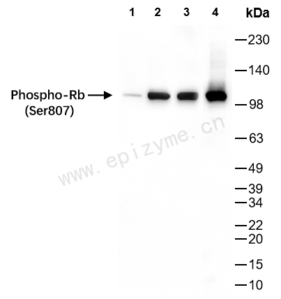 Anti-Phospho-Rb (Ser807) Rabbit mAb [26M34N91]