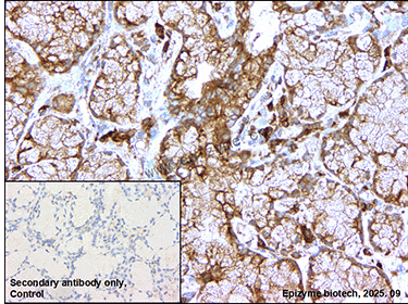 Anti-RAB8A Rabbit mAb [14R61E87]