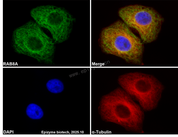 Anti-RAB8A Rabbit mAb [14R61E87]