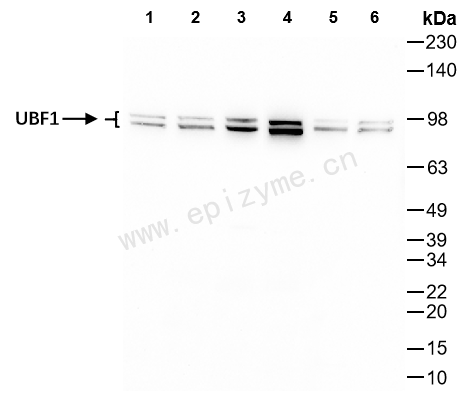 Anti-UBTF Rabbit mAb [35E92A52]