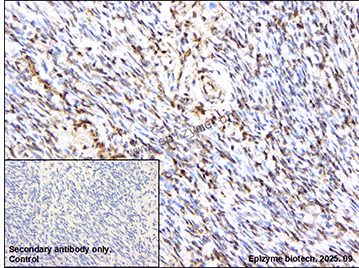 Anti-UBTF Rabbit mAb [35E92A52]