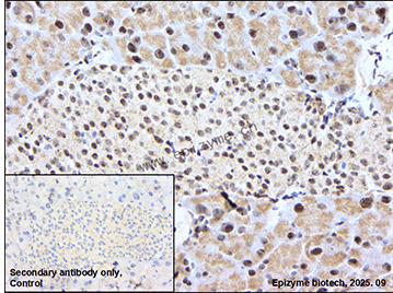Anti-UBTF Rabbit mAb [35E92A52]
