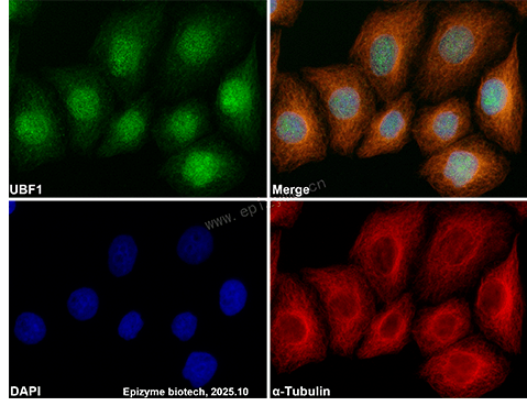 Anti-UBTF Rabbit mAb [35E92A52]