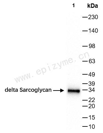 Anti-Delta-sarcoglycan/SGCD Rabbit mAb [62I51Q05]