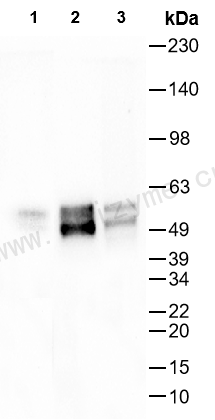 Anti-MEF2C Rabbit mAb [90K36J13]