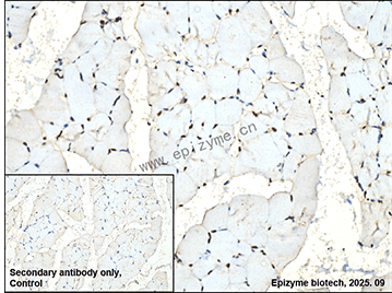 Anti-MEF2C Rabbit mAb [90K36J13]