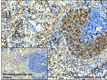 Anti-MEF2C Rabbit mAb [90K36J13]