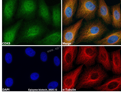 Anti-CDK5 Mouse mAb [42M82M82]
