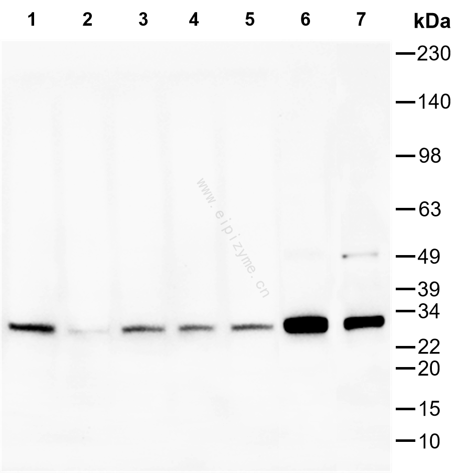 Anti-CDK5 Mouse mAb [42M82M82]