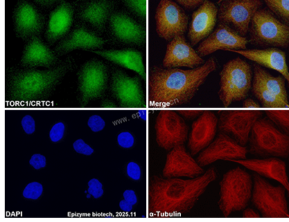 Anti-TORC1 Mouse mAb [58L74L97]