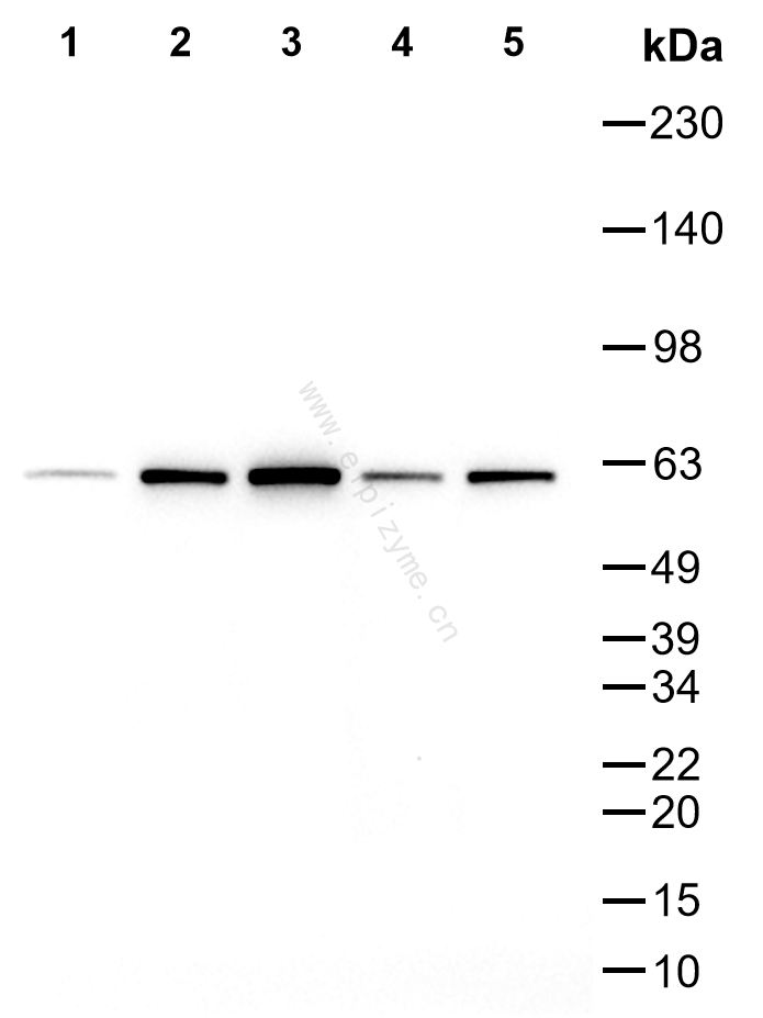 Anti-PAK2 Mouse mAb [35M51M90]
