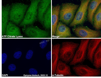 Anti-ATP citrate lyase Mouse mAb [97K18M95]