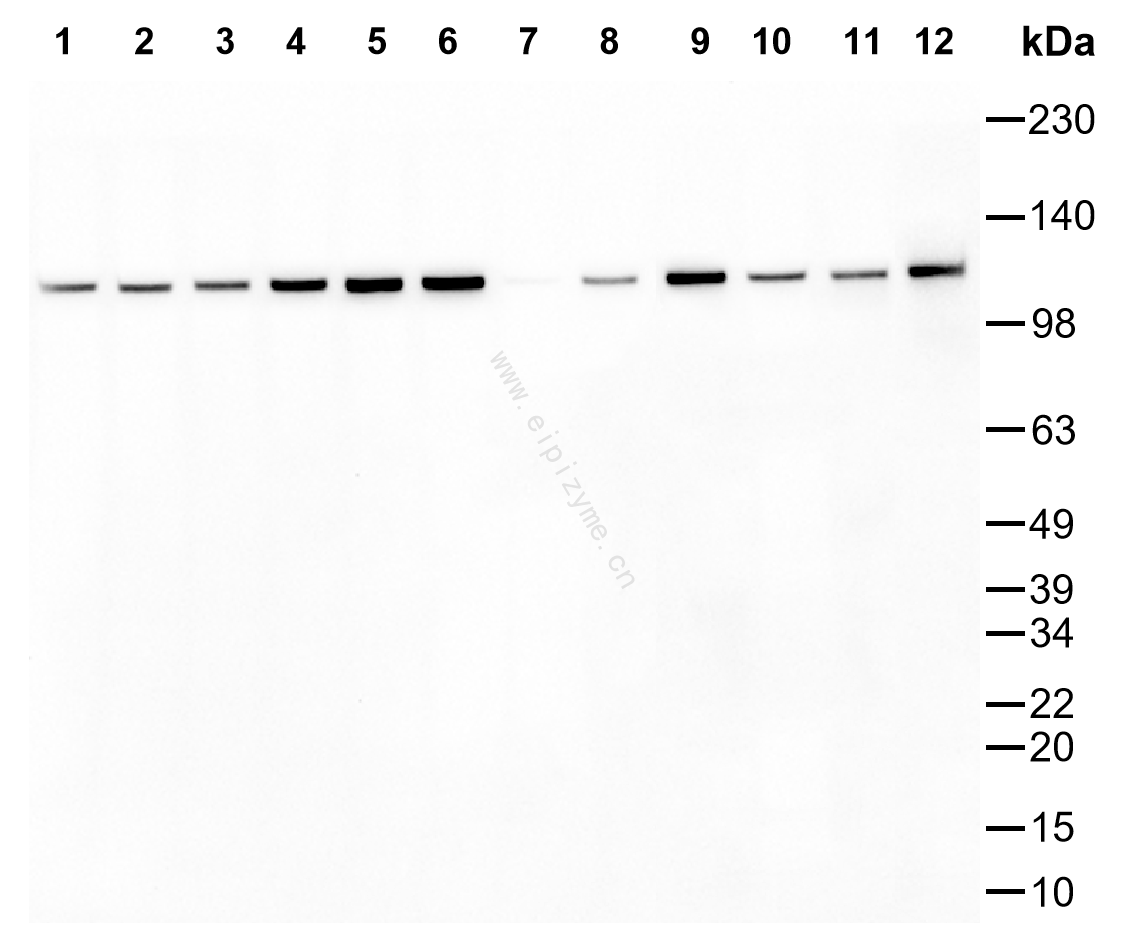 Anti-ATP citrate lyase Mouse mAb [97K18M95]
