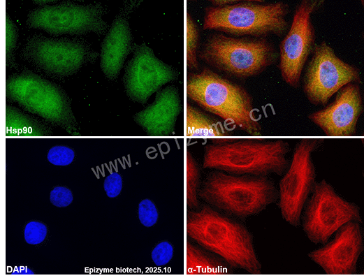 Anti-Hsp90 Mouse mAb [91M01L08]