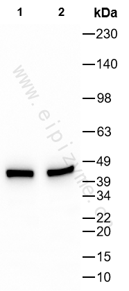 Anti-SIRT2 Mouse mAb [22K86L74]