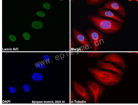 Anti-Lamin A/C Mouse mAb [49L05L34]