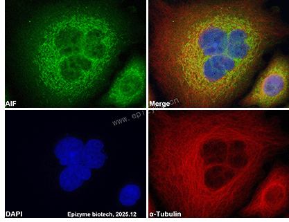 Anti-AIF Mouse mAb [85K06M56]