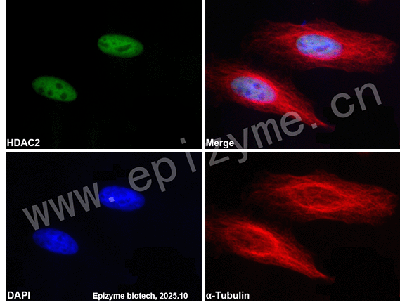Anti-HDAC2 Mouse mAb [91L51L04]