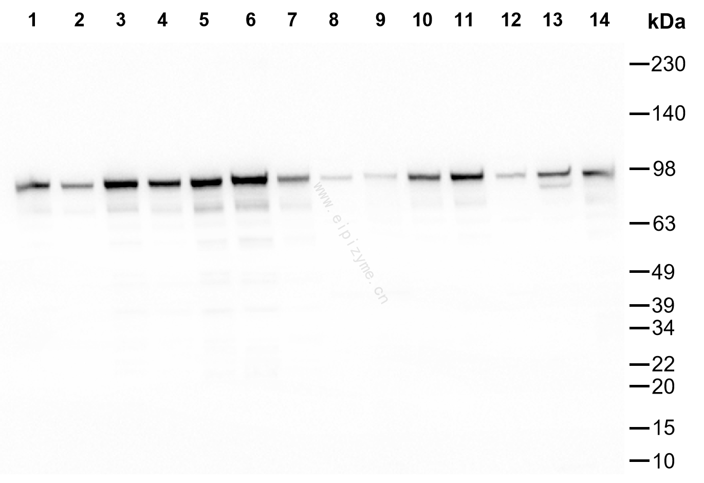Anti-Elongation factor 2 Mouse mAb [21M13L15]