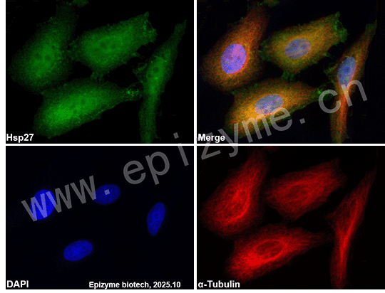 Anti-Hsp27 Mouse mAb [95K02K34]