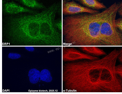 Anti-DRP1 Mouse mAb [35K09L62]