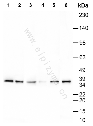 Anti-AMPK beta 1 Mouse mAb [98M57M46]