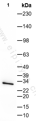 Anti-BCL2 Mouse mAb [38E14L26]