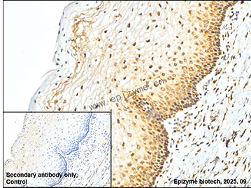 Anti-BCL2 Mouse mAb [38E14L26]
