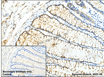 Anti-BCL2 Mouse mAb [38E14L26]