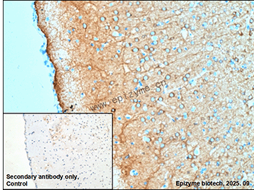 Anti-Phospholipase C beta 1 Rabbit mAb [50M91M60]