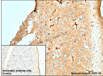 Anti-Phospholipase C beta 1 Rabbit mAb [50M91M60]