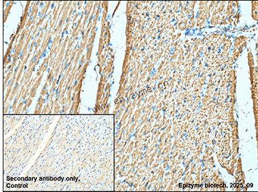 Anti-Complex III Subunit 7 Rabbit mAb [18K07L64]