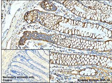 Anti-Complex III Subunit 7 Rabbit mAb [18K07L64]