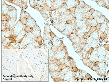 Anti-Complex III Subunit 7 Rabbit mAb [18K07L64]