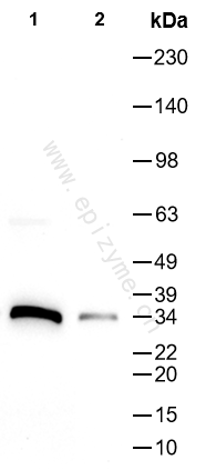 Anti-HMGCL Rabbit mAb [98M42L14]
