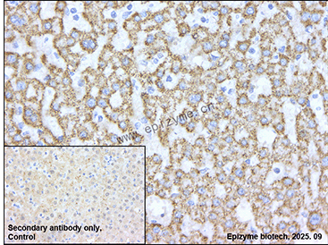 Anti-HMGCL Rabbit mAb [98M42L14]