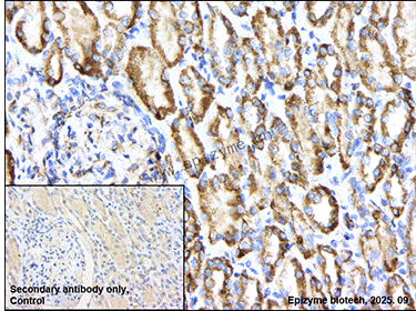 Anti-HMGCL Rabbit mAb [98M42L14]