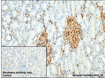Anti-Phospho-beta Arrestin 1 (Ser412) Rabbit mAb [58K21K26]