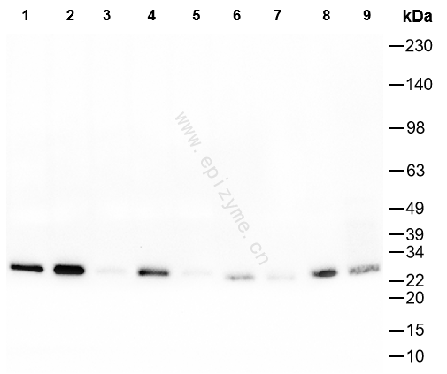 Anti-Phospho-p27 KiP 1 (Ser10) Rabbit mAb [18L98M30]