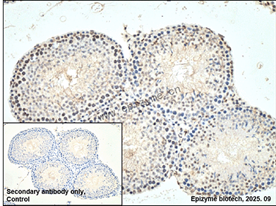 Anti-Phospho-p27 KiP 1 (Ser10) Rabbit mAb [18L98M30]