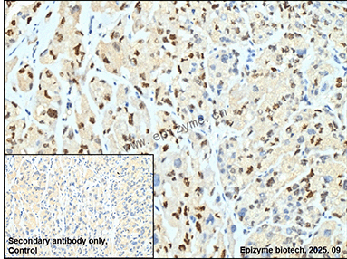 Anti-Phospho-p27 KiP 1 (Ser10) Rabbit mAb [18L98M30]