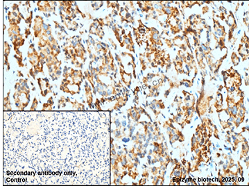 Anti-Phospho-p53 (Ser6) Rabbit mAb [62K64K10]