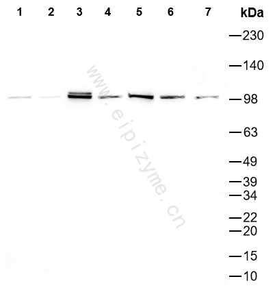 Anti-Phospho-Rb (Ser811) Rabbit mAb [20M82L17]