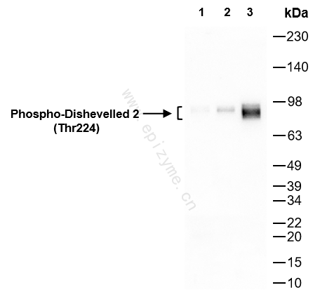Anti-Phospho-Dishevelled 2 (Thr224) Rabbit mAb [70B07F41]