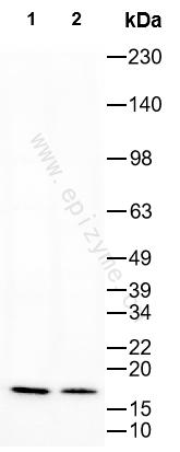 Anti-Phospho-Stathmin 1 (Ser63) Rabbit mAb [31A08S97]