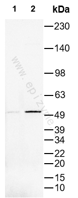 Anti-Phospho-CaMKII alpha/beta (Thr286) Rabbit mAb [99T85E37]