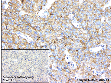 Anti-MAP4K1/HPK1 Rabbit mAb [52R32J96]